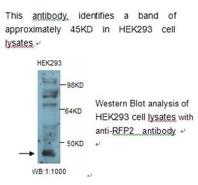 RFP2 Antibody from Signalway Antibody (39235) - Antibodies.com