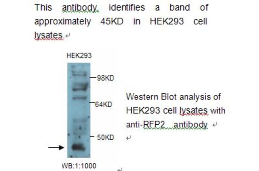 RFP2 Antibody from Signalway Antibody (39235) - Antibodies.com