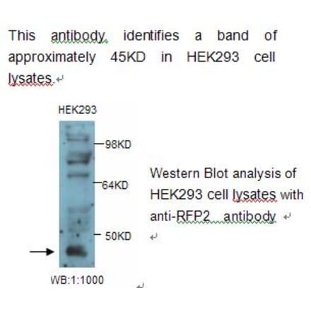 RFP2 Antibody from Signalway Antibody (39235) - Antibodies.com