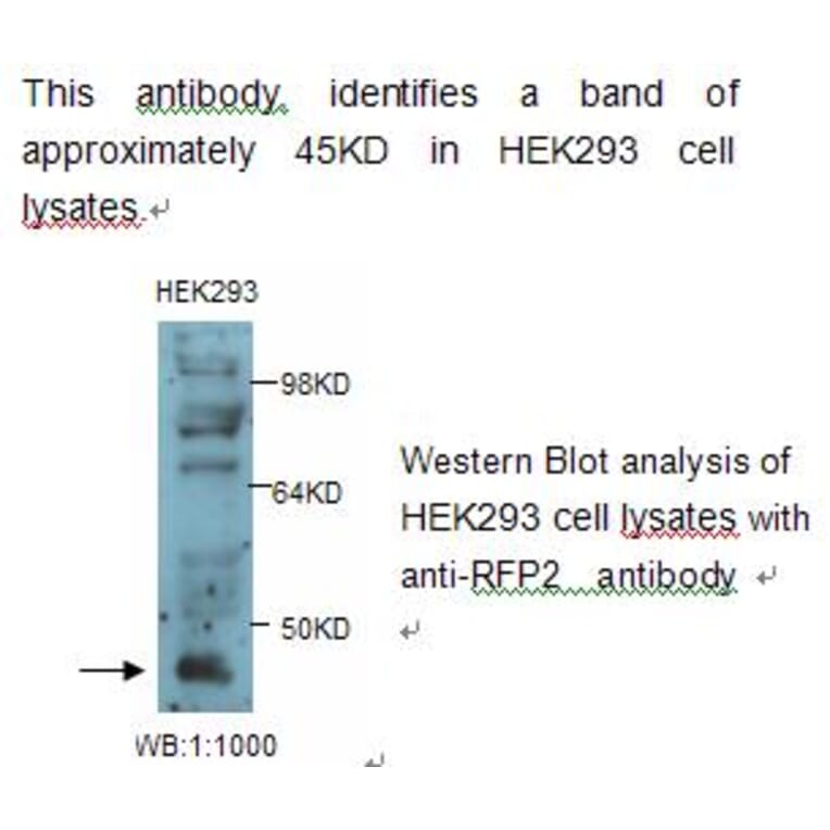 RFP2 Antibody from Signalway Antibody (39235) - Antibodies.com