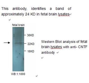 CNTF Antibody from Signalway Antibody (39240) - Antibodies.com