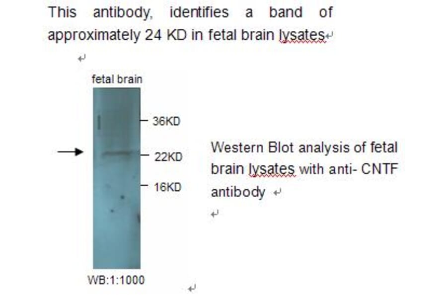 CNTF Antibody from Signalway Antibody (39240) - Antibodies.com