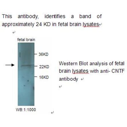 CNTF Antibody from Signalway Antibody (39240) - Antibodies.com
