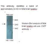 CNTF Antibody from Signalway Antibody (39240) - Antibodies.com