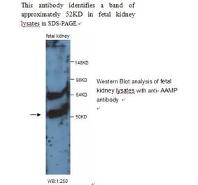 AAMP Antibody from Signalway Antibody (39243) - Antibodies.com
