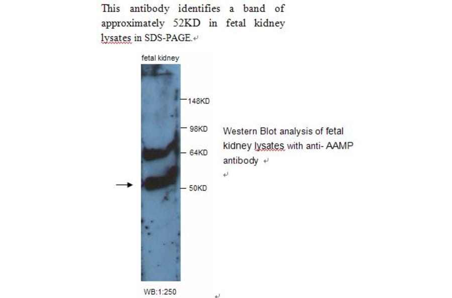 AAMP Antibody from Signalway Antibody (39243) - Antibodies.com