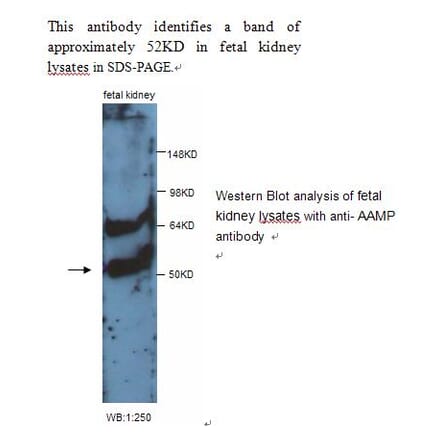 AAMP Antibody from Signalway Antibody (39243) - Antibodies.com