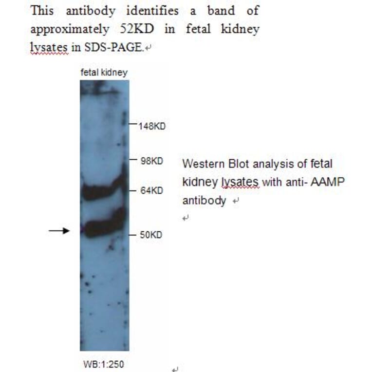 AAMP Antibody from Signalway Antibody (39243) - Antibodies.com
