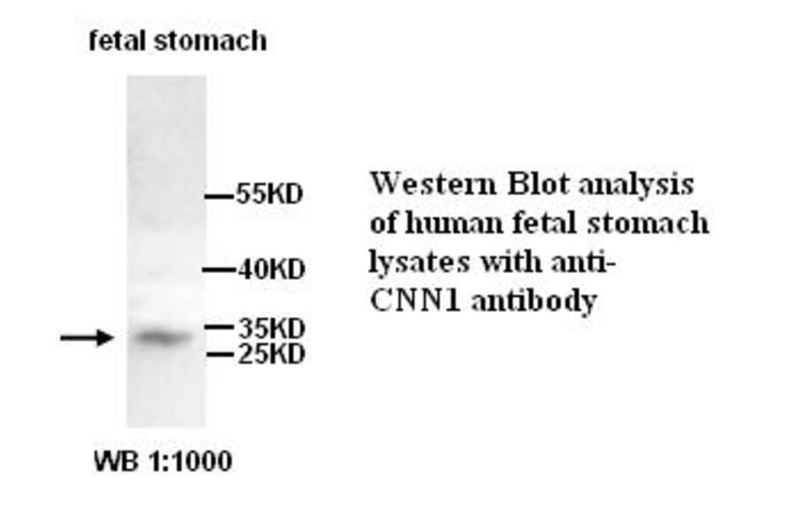 CNN1 Antibody from Signalway Antibody (39255) - Antibodies.com