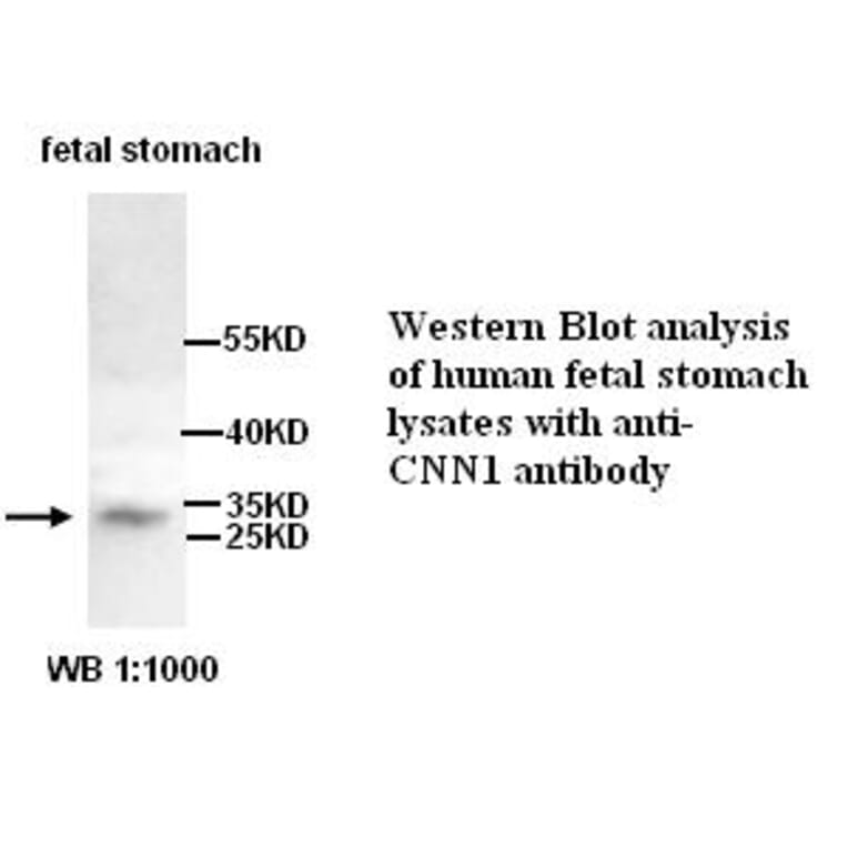 CNN1 Antibody from Signalway Antibody (39255) - Antibodies.com