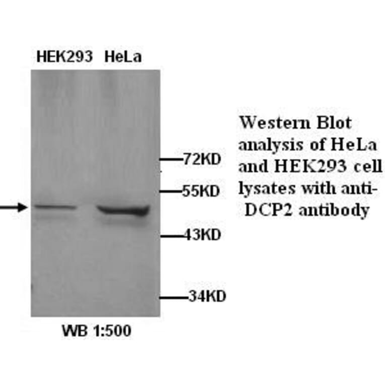 DCP2 Antibody from Signalway Antibody (39263) - Antibodies.com