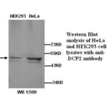 DCP2 Antibody from Signalway Antibody (39263) - Antibodies.com