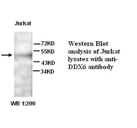 DDX6 Antibody from Signalway Antibody (39267) - Antibodies.com