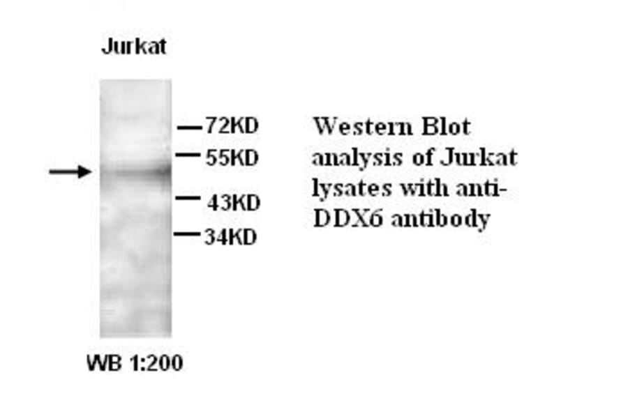 DDX6 Antibody from Signalway Antibody (39267) - Antibodies.com