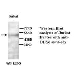 DDX6 Antibody from Signalway Antibody (39267) - Antibodies.com