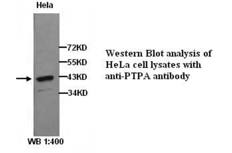 PTPA Antibody from Signalway Antibody (39278) - Antibodies.com