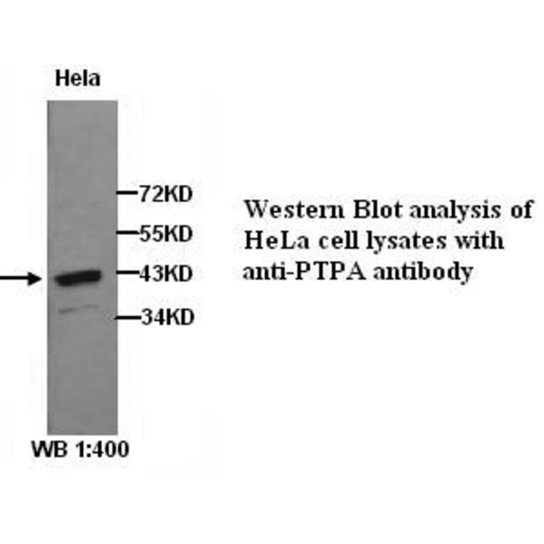 PTPA Antibody from Signalway Antibody (39278) - Antibodies.com