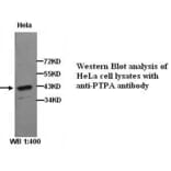PTPA Antibody from Signalway Antibody (39278) - Antibodies.com