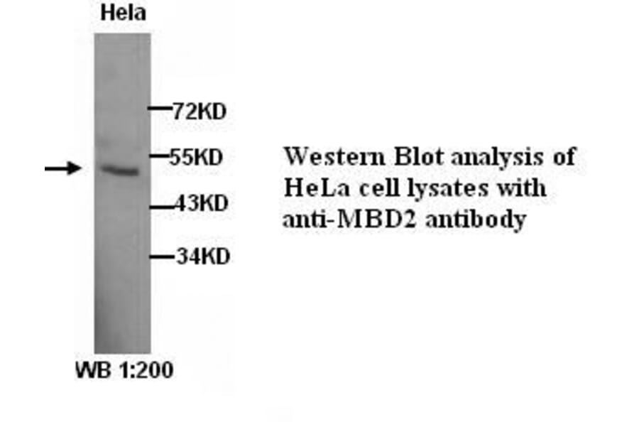 MBD2 Antibody from Signalway Antibody (39279) - Antibodies.com