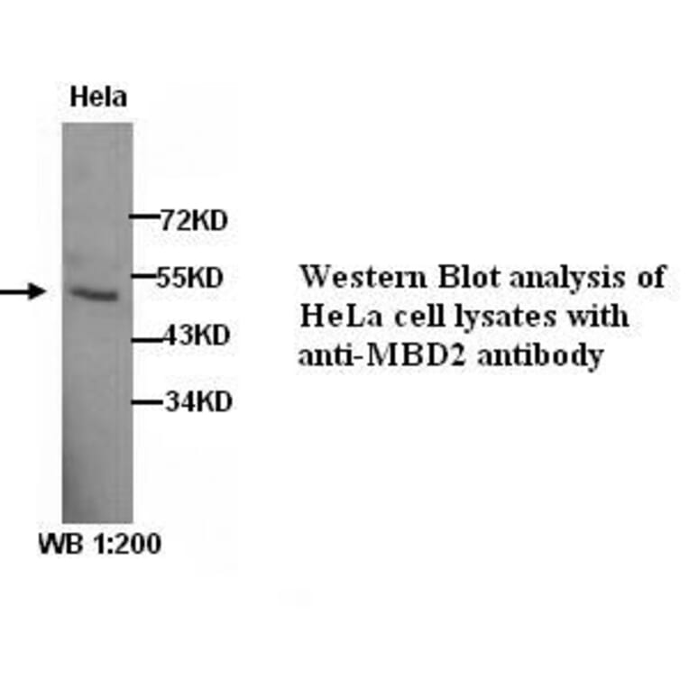 MBD2 Antibody from Signalway Antibody (39279) - Antibodies.com