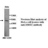 MBD2 Antibody from Signalway Antibody (39279) - Antibodies.com