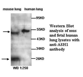 ASH1 Antibody from Signalway Antibody (39282) - Antibodies.com