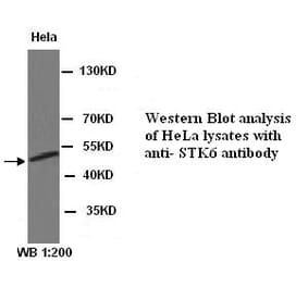 STK6 Antibody from Signalway Antibody (39312) - Antibodies.com