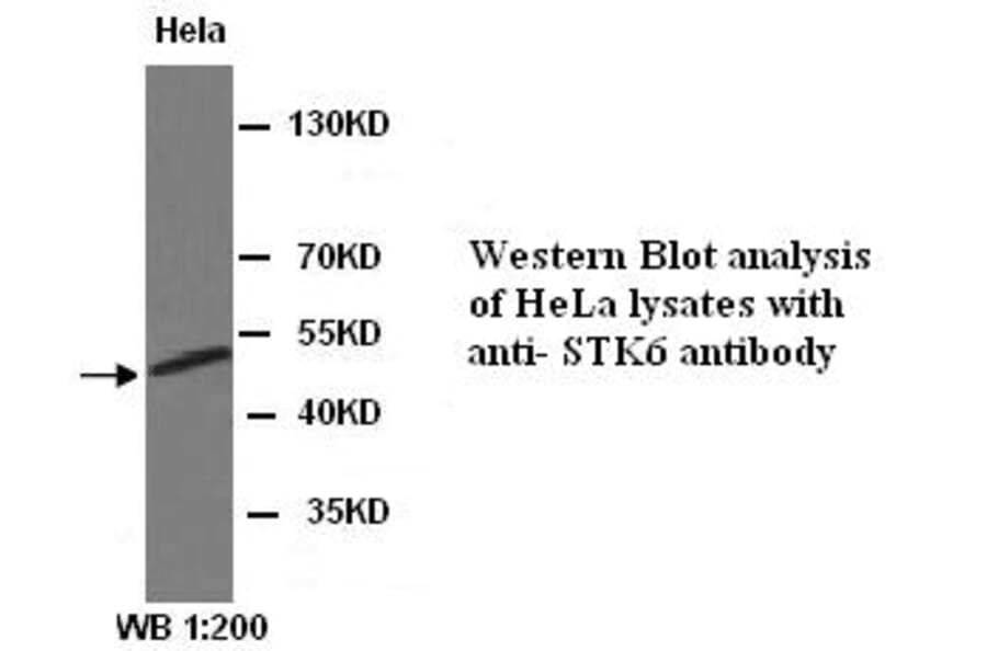 STK6 Antibody from Signalway Antibody (39312) - Antibodies.com