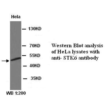 STK6 Antibody from Signalway Antibody (39312) - Antibodies.com