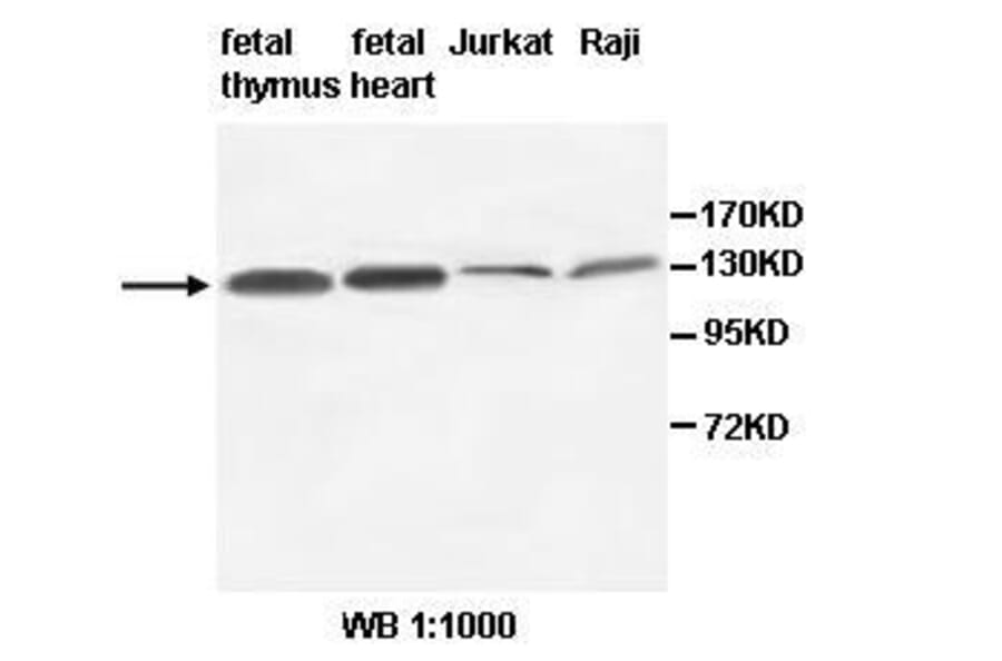 AFF3 Antibody from Signalway Antibody (39514) - Antibodies.com