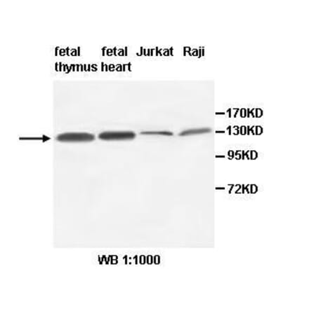 AFF3 Antibody from Signalway Antibody (39514) - Antibodies.com