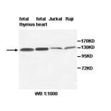 AFF3 Antibody from Signalway Antibody (39514) - Antibodies.com