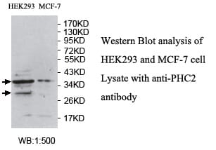 Anti-PHC2 Antibody