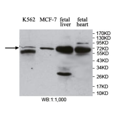 MBD4 Antibody from Signalway Antibody (39750) - Antibodies.com