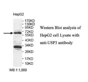 USP3 Antibody from Signalway Antibody (39925) - Antibodies.com