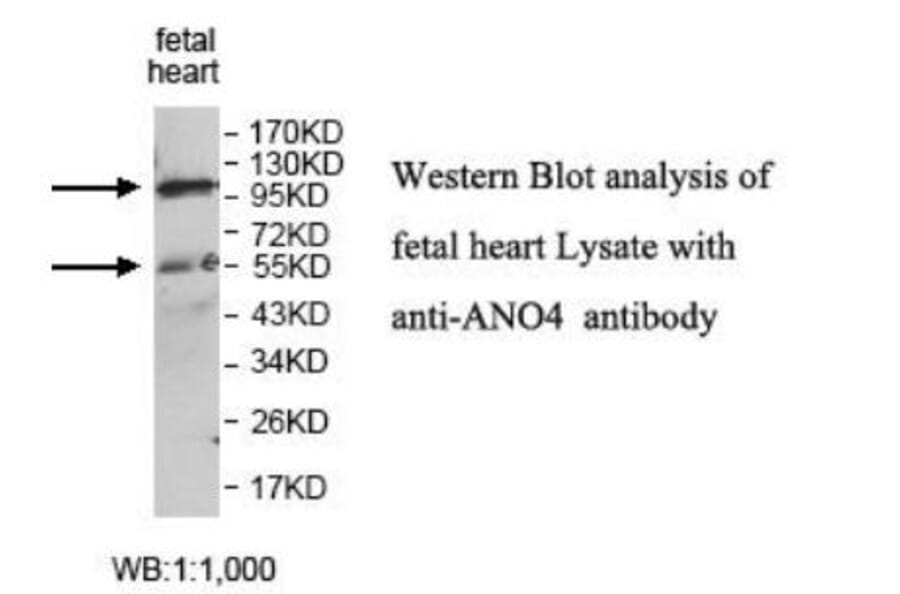 ANO4 Antibody from Signalway Antibody (39927) - Antibodies.com