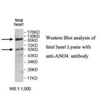 ANO4 Antibody from Signalway Antibody (39927) - Antibodies.com