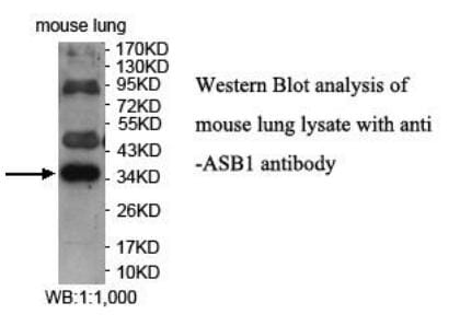 Anti-ASB1 Antibody