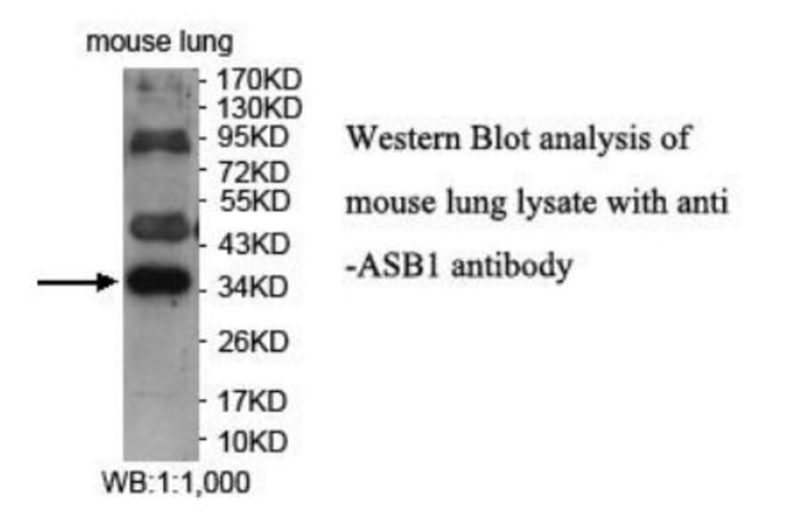 ASB1 Antibody from Signalway Antibody (39940) - Antibodies.com