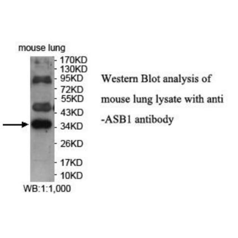 ASB1 Antibody from Signalway Antibody (39940) - Antibodies.com