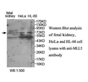 MLL5 Antibody from Signalway Antibody (39945) - Antibodies.com
