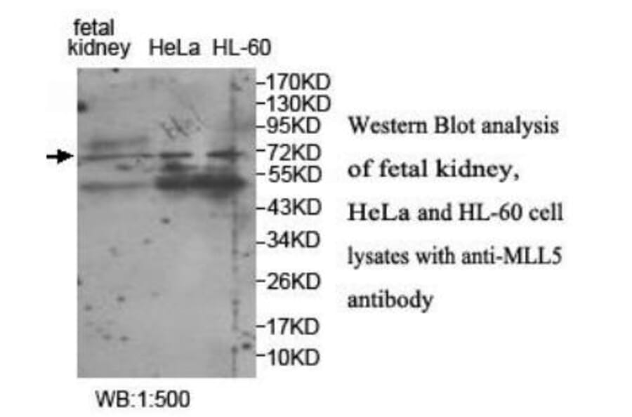 MLL5 Antibody from Signalway Antibody (39945) - Antibodies.com