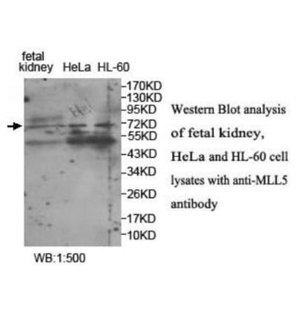 MLL5 Antibody from Signalway Antibody (39945) - Antibodies.com