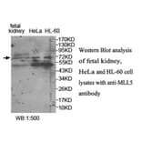 MLL5 Antibody from Signalway Antibody (39945) - Antibodies.com