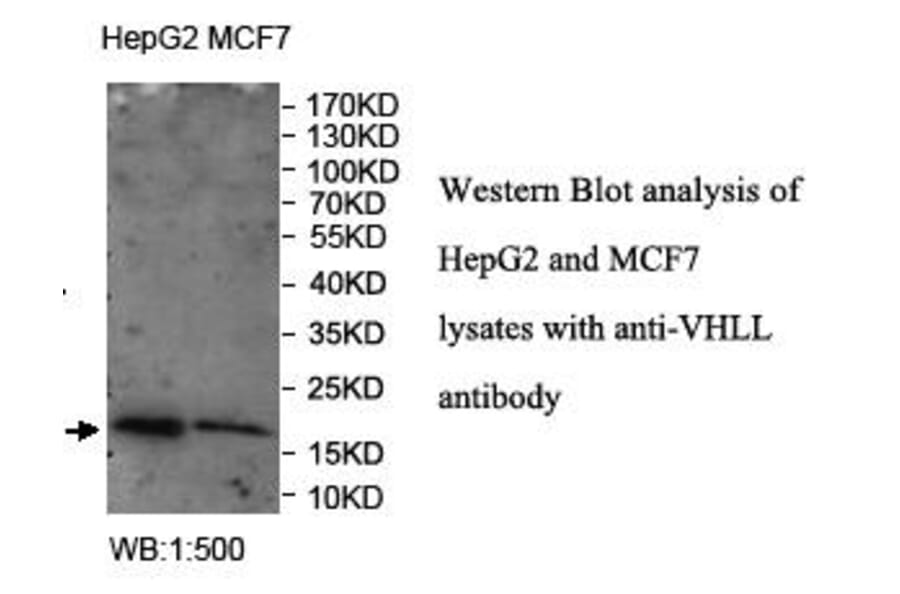 VHLL Antibody from Signalway Antibody (39963) - Antibodies.com