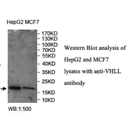 VHLL Antibody from Signalway Antibody (39963) - Antibodies.com