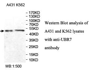 Anti-UBR7 Antibody