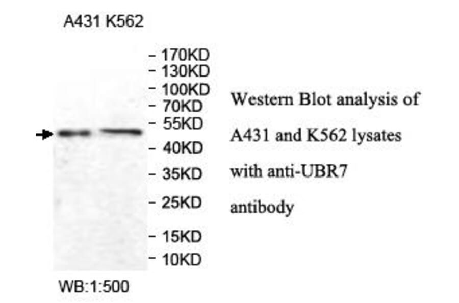 UBR7 Antibody from Signalway Antibody (39977) - Antibodies.com