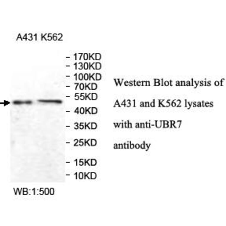 UBR7 Antibody from Signalway Antibody (39977) - Antibodies.com
