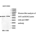UBR7 Antibody from Signalway Antibody (39977) - Antibodies.com